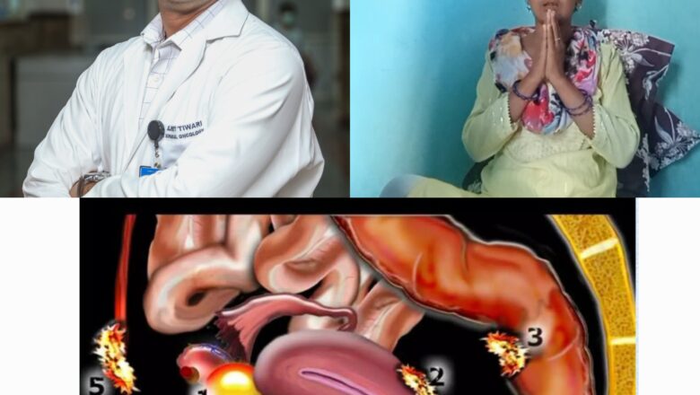 चिकित्सा जगत में एक नई मिसाल कायम करते हुए श्री महंत इन्दिरेश अस्पताल के वरिष्ठ कैंसर सर्जन डॉ. अजीत तिवारी और उनकी टीम ने एक महिला मरीज की स्टेज-3 एडवांस कोलन कैंसर सर्जरी सफलतापूर्वक कर उसे नया जीवन प्रदान किया है।   